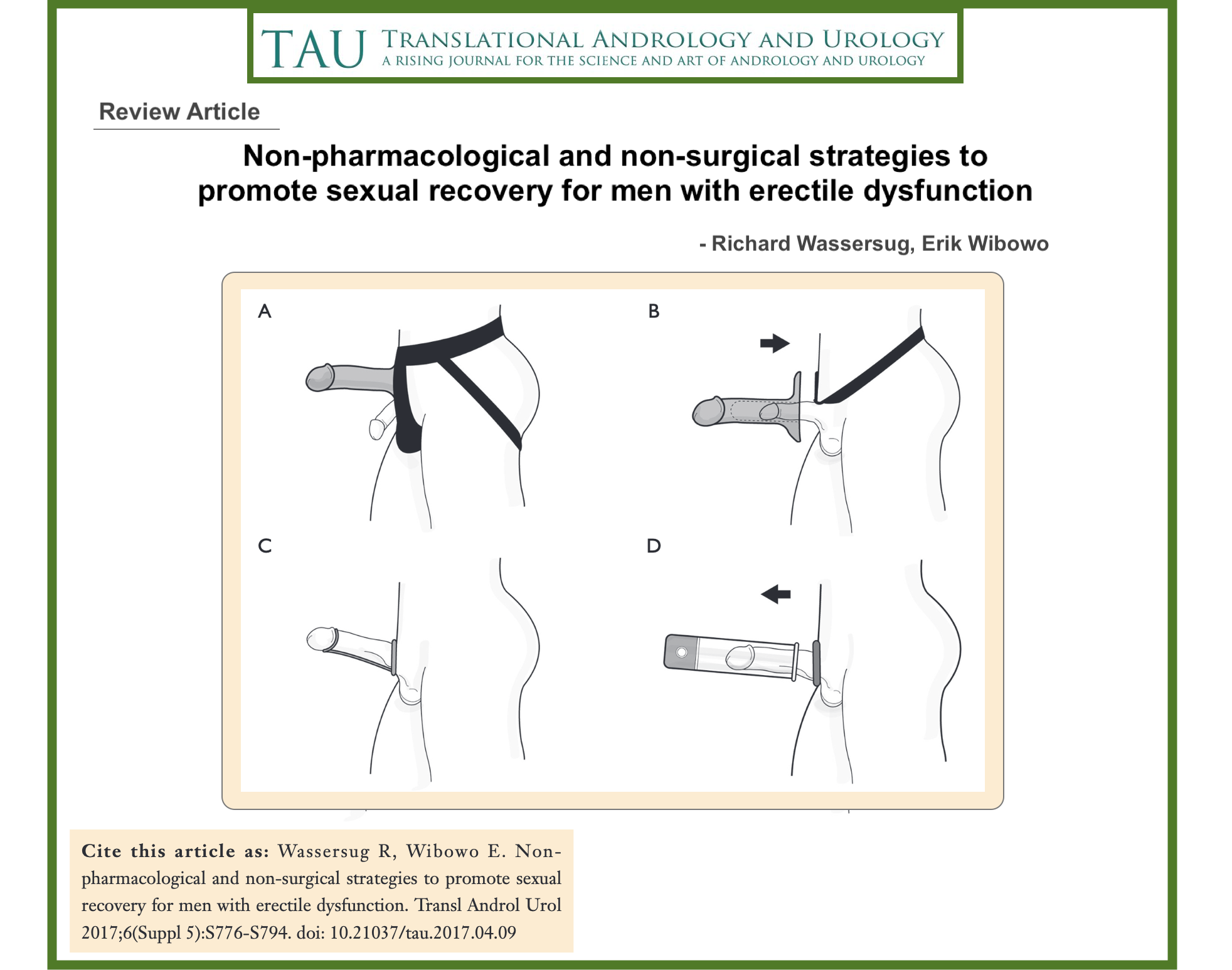 A Non-Surgical Solution for Erectile Dysfunction